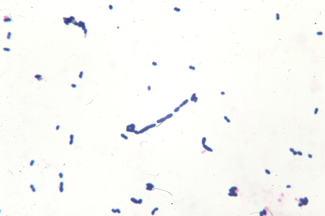 staphylococcus aureus gram stain. gram specimen Stain and s