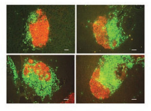  (b) Immunohistochemical analysis of pancreas sections from 12-week-old female mice stained for CD3 (green) and insulin (red). Top left, section of pancreas from a female NOD CAM mouse. Top right, bottom left and bottom right, sections of pancrea