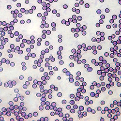 Blood Smear (Laman)