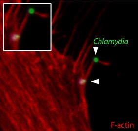 Figure shows early encounters between C.trachomatis elementary bodies (green, diameter ~300nm) and cultured epithelial cells. Arrowheads indicate bacteria captured in association with actin-rich (F-actin, red) finger-like projections termed filopodia on t