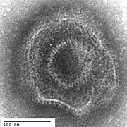  Electron micrograph of a herpes simplex virus type-1 (HSV-1) particle.