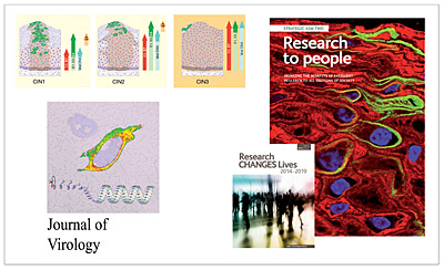 Our past work has identified important changes in viral gene expression that underlie the development of HPV-associated cervical intraepithelial neoplasias (top left). A series of molecular studies that we have published in the Journal of Virology over th