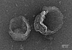 Exosomes-TEM