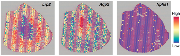  Spatial Transcriptomics of the Human kidney. Dixon&nbsp;EE,&nbsp;et al.&nbsp;Spatially resolved transcriptomic analysis of acute kidney injury in a female murine model.&nbsp;J Am Soc Nephrol&nbsp;2022