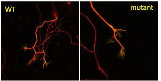 Labelled Neurons (left WT, right mutant)