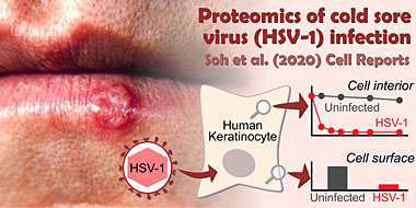 Proteomics of HSV-1 infection