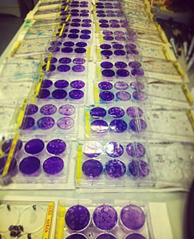 Zika virus titrations