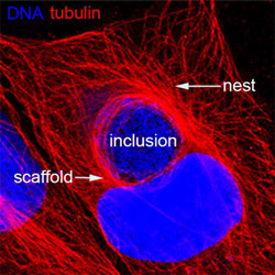 hayward1 Confocal immunofluorescence micrograph showing a C.trachomatis inclusion within an infected cell surrounded by a ‘scaffold and nest’ of microtubules reorganised by the effector IPAM (see Dumoux et al, 2015).