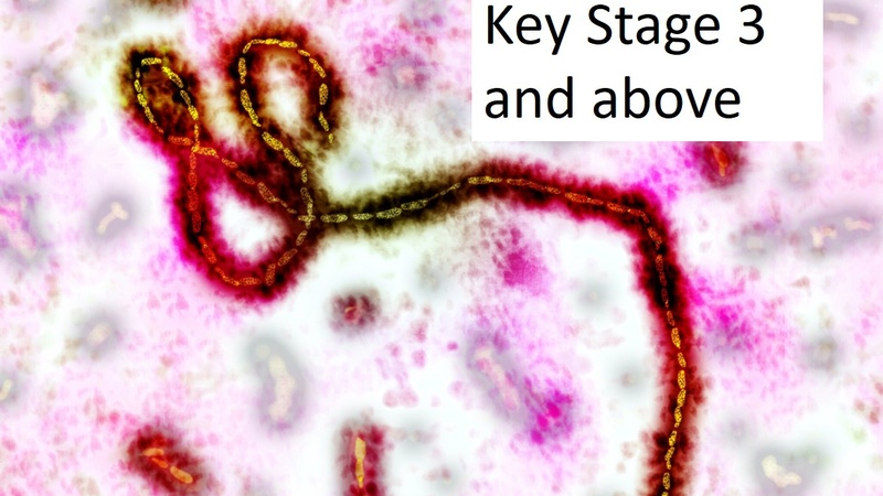 Ebola virus