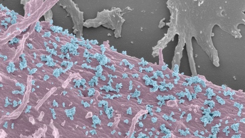 magnified virus