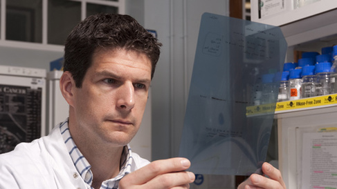 Murray investigating circulating microRNA biomarkers