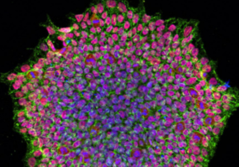 HUman pluripotent stem cell