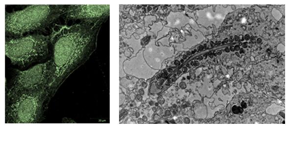 electron microscopy of the developing spermatocyte electron microscopy of the developing spermatocyte