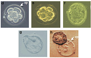 Human pre-implantation embryos developing in vitro. Following fertilization, the embryo divides while remaining within the translucent zona pellucida (zp, arrowed). Shown are the 8 cell stage (d), the early morula stage of approximately 16 cells (e), the 