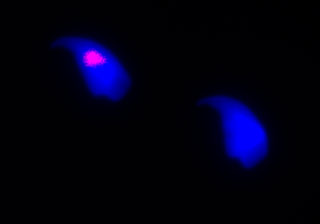 Figure 1 Mouse sperm nuclei stained with DAPI. The pink signal is from in situ hybridization of a Y specific DNA probe to the Y chromosome.