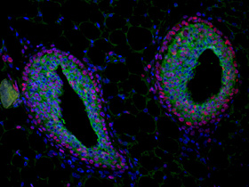 A mammary gland terminal end bud fluorescently stained with antibodies to the cell adhesion protein E-cadherin (green) and the marker of proliferation PCNA (red) with the nuclei of the cells in blue.