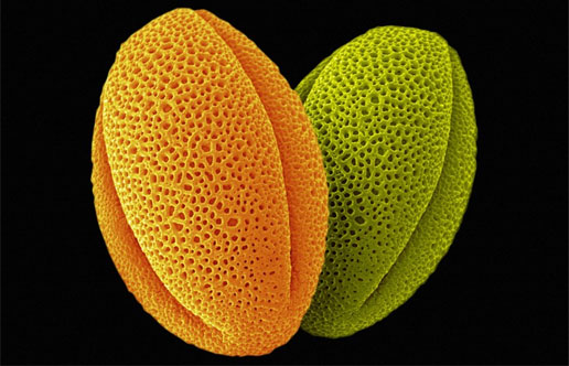 Two grains of pollen from a peony. Credit: Annie Cavanagh, Wellcome Images.