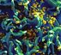 Scientists find mutant protein blocks HIV infection and transmission